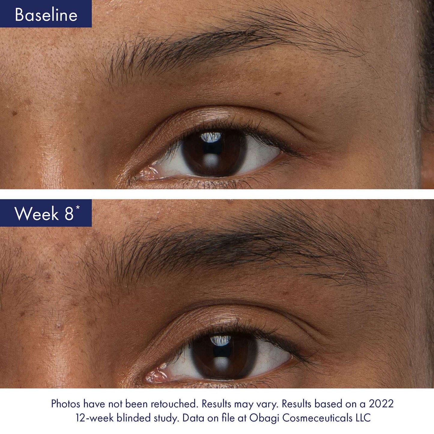 Obagi Nu-Cil Eyebrow Boosting Serum